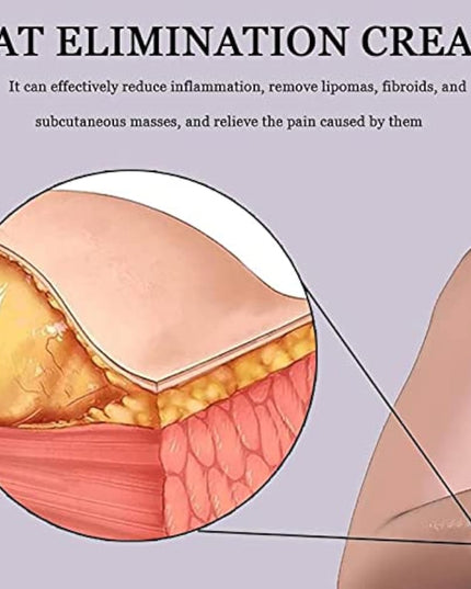 Lip removal cream cellulite removal ointment skin swelling lipolysis fat mass body hard block removal medicine 20g