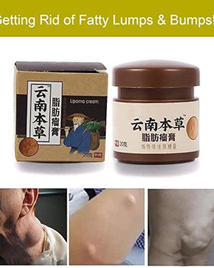 Lip removal cream cellulite removal ointment skin swelling lipolysis fat mass body hard block removal medicine 20g