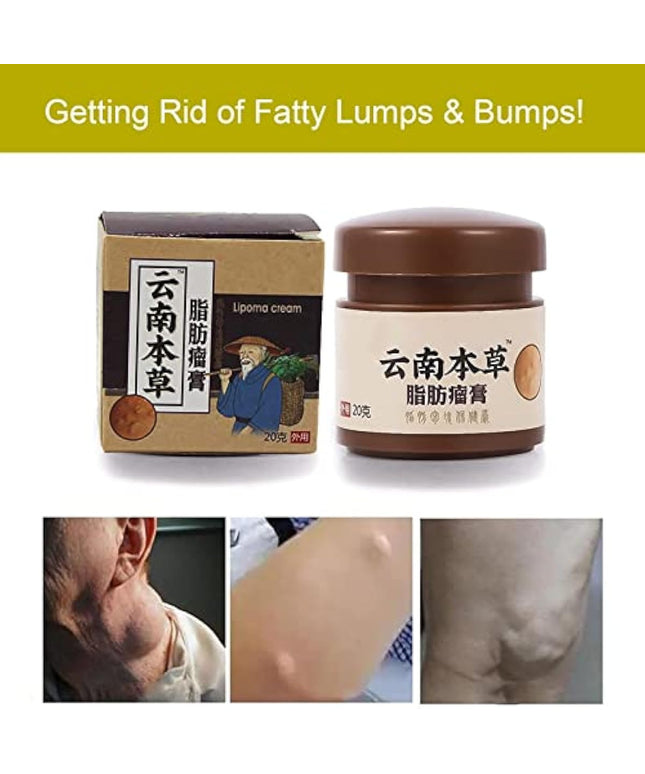 Lip removal cream cellulite removal ointment skin swelling lipolysis fat mass body hard block removal medicine 20g