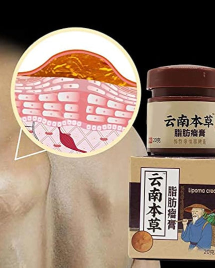 Lip removal cream cellulite removal ointment skin swelling lipolysis fat mass body hard block removal medicine 20g