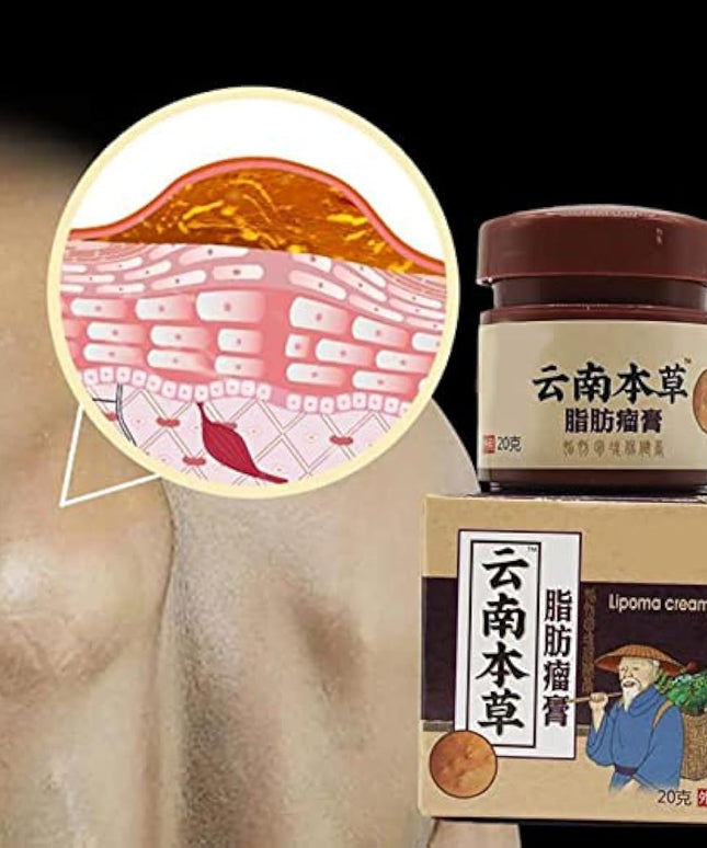Lip removal cream cellulite removal ointment skin swelling lipolysis fat mass body hard block removal medicine 20g