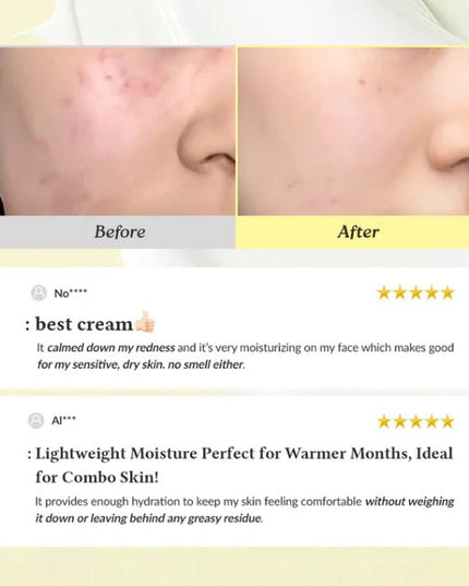 345 Relief Cream - Post acne Cream Cosmetics –