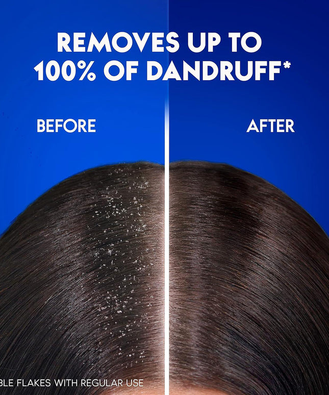 2Head & Shoulders Smooth & Silky 2X400 ml